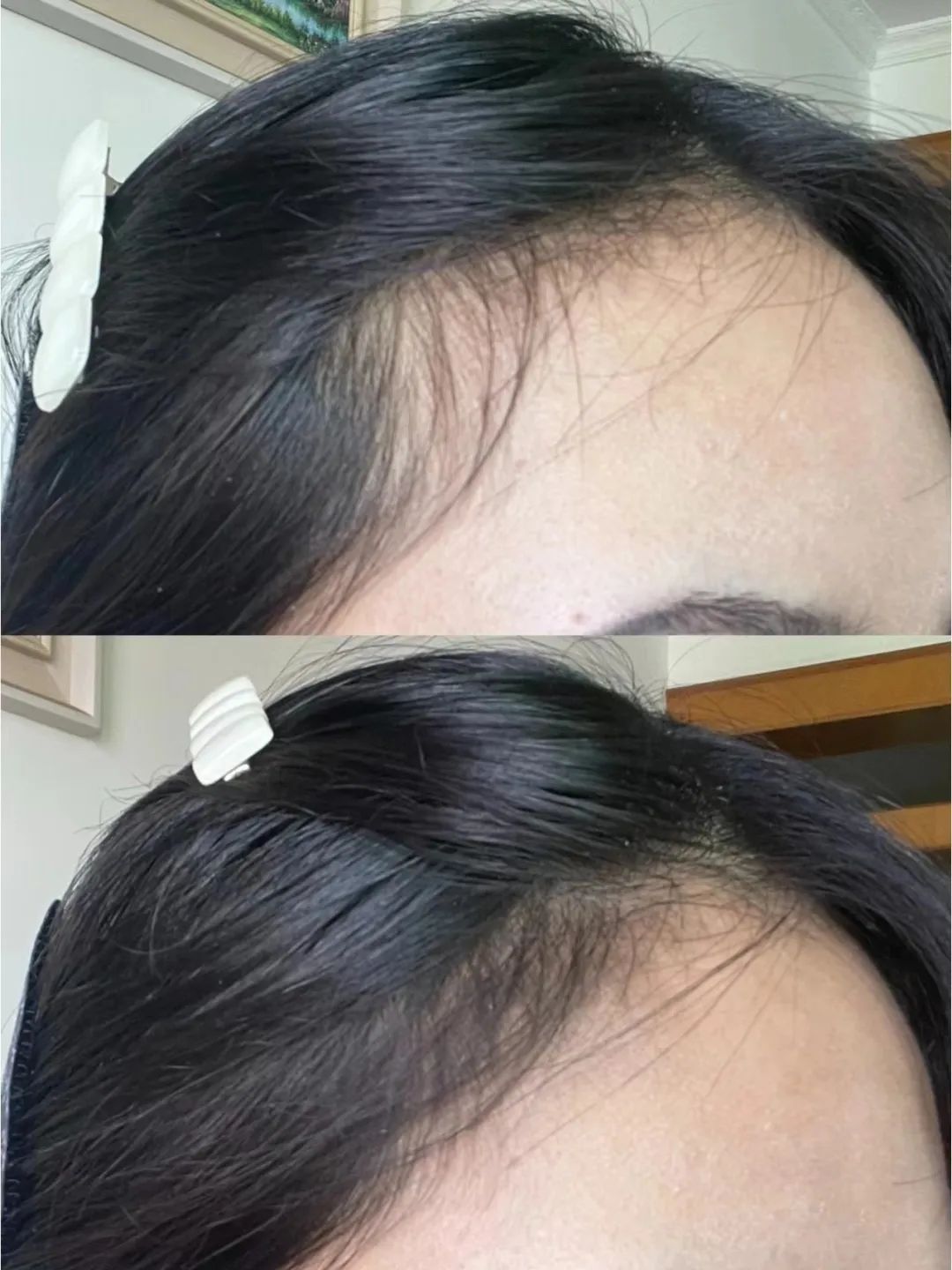 杨超越整过容吗,杨超越有没有整过容