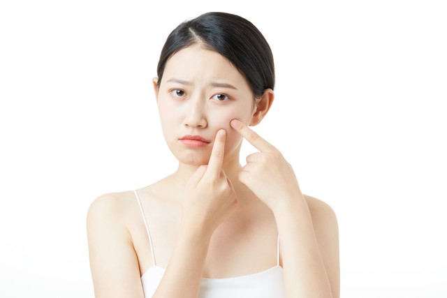 嘴角经常冒痘痘怎样治,嘴角冒痘