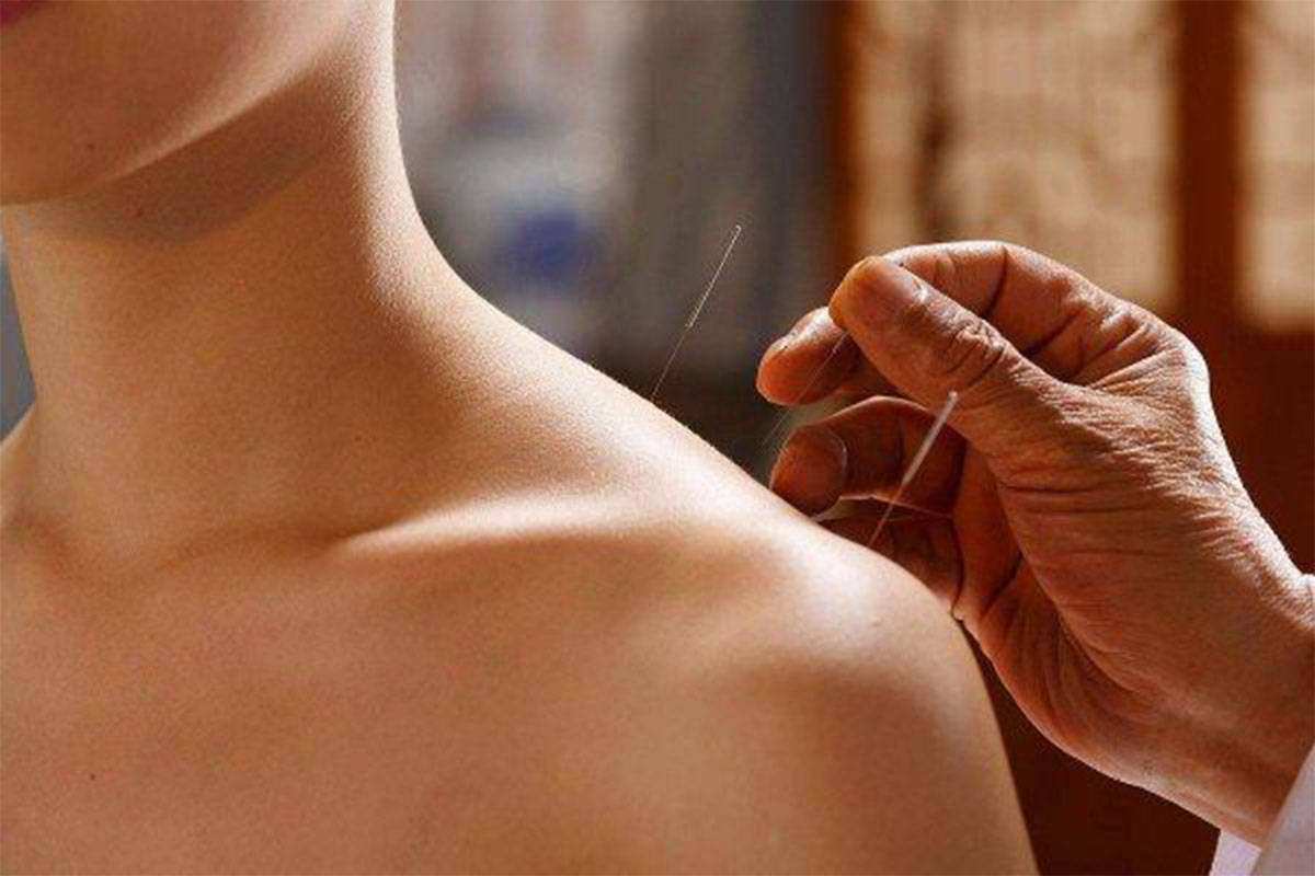 肩周炎扎针灸扎哪个部位教程,刘红云治疗肩周炎的针灸视频