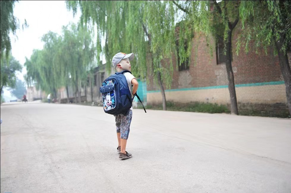 小孩被火烧伤戴面具,面具娃娃烧伤