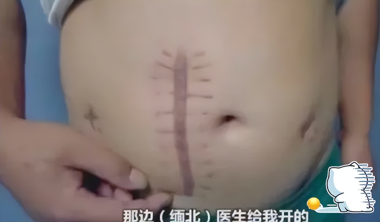 缅北诈骗人冒充被拐的人回国,深入了解缅北骗局