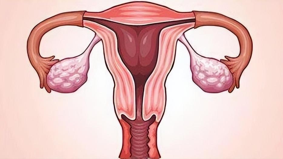 子宫内膜癌有什么征兆,子宫内膜癌最怕三个征兆