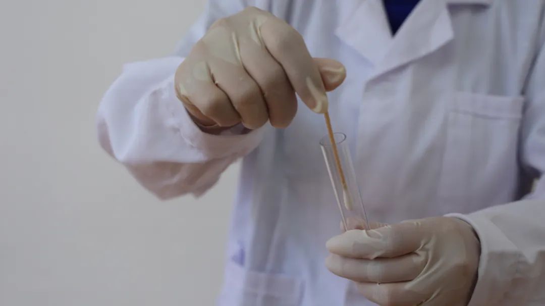 女性支原体感染白带血丝,女性排卵期白带有血丝正常吗