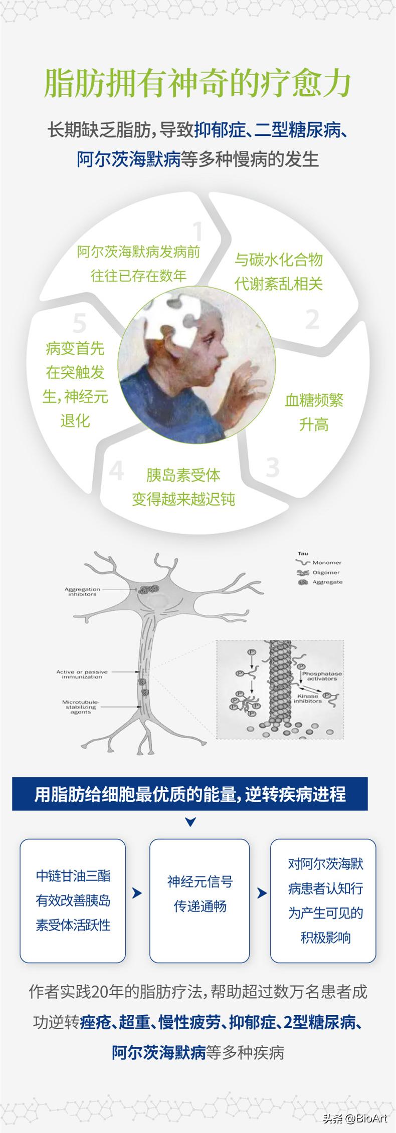 脑漏的真正原因,肠漏症和脑漏症