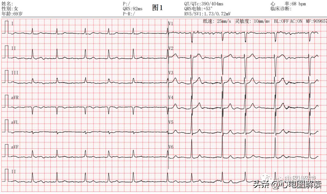 灏忓効蹇冩埧棰ゅ姩,蹇冩埧棰ゅ姩璇句欢