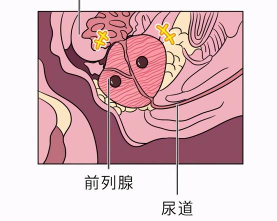 一位单身女青年的疑问：同房时，男人射精和尿尿会同时发生吗？