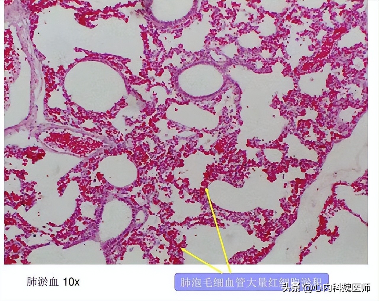 控制冠心病的药,治疗心血管疾病的药物哪个最好