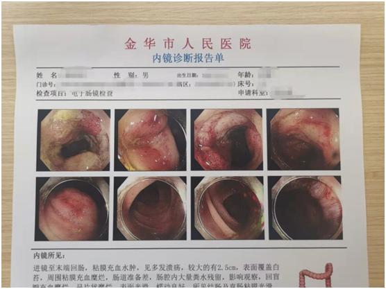 最简单的痛风，为什么却有许多痛风患者后果很严重？