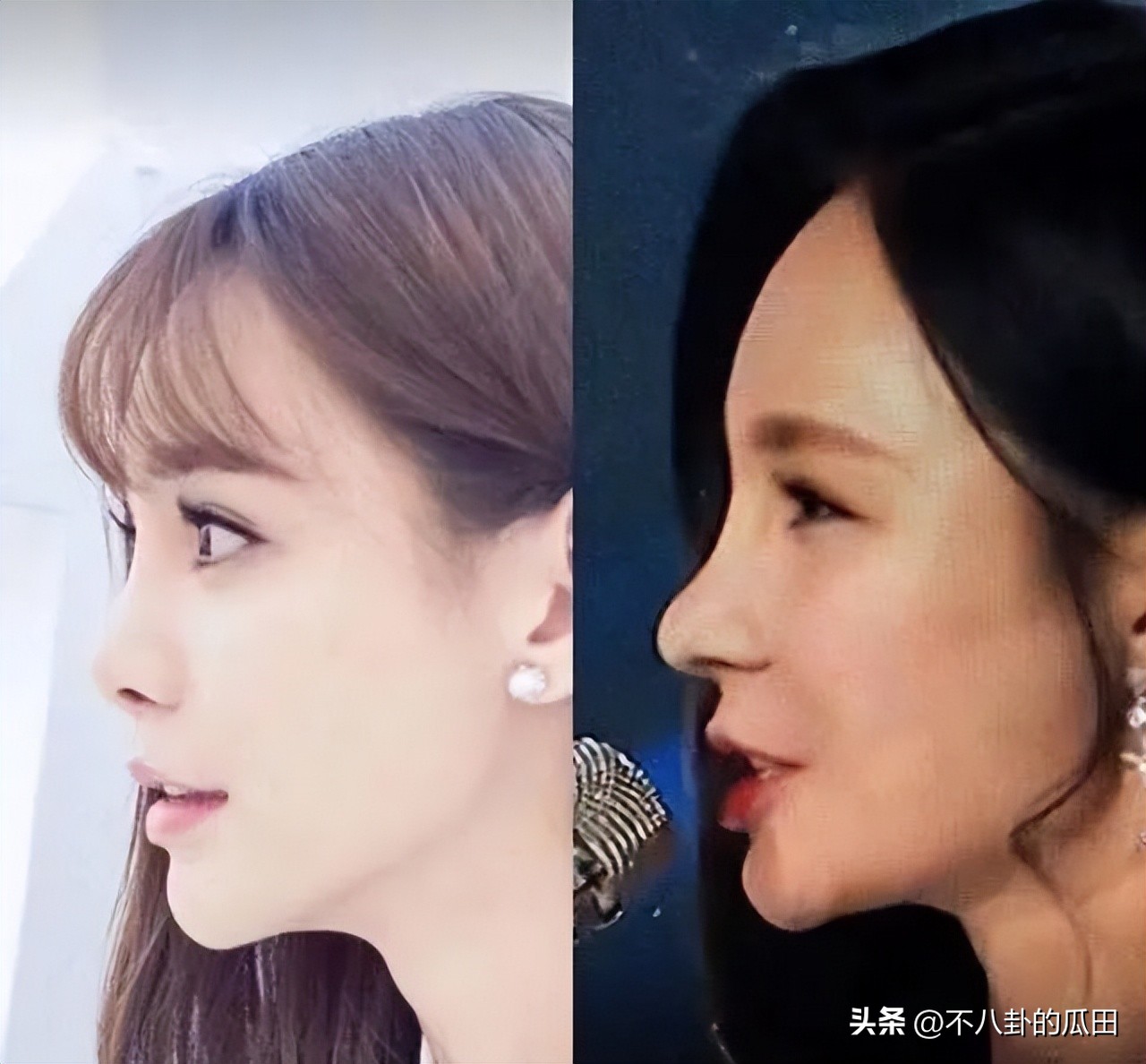 蔡徐坤下巴太尖惹争议图片,蔡徐坤下巴是假体吗