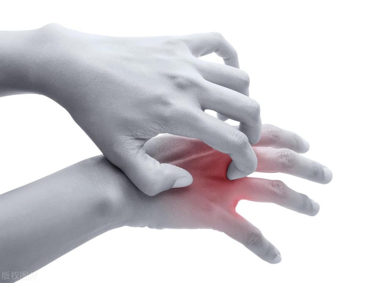 吃异维a酸手背红疹需要停药吗,异维a酸软胶囊吃后手背起红斑