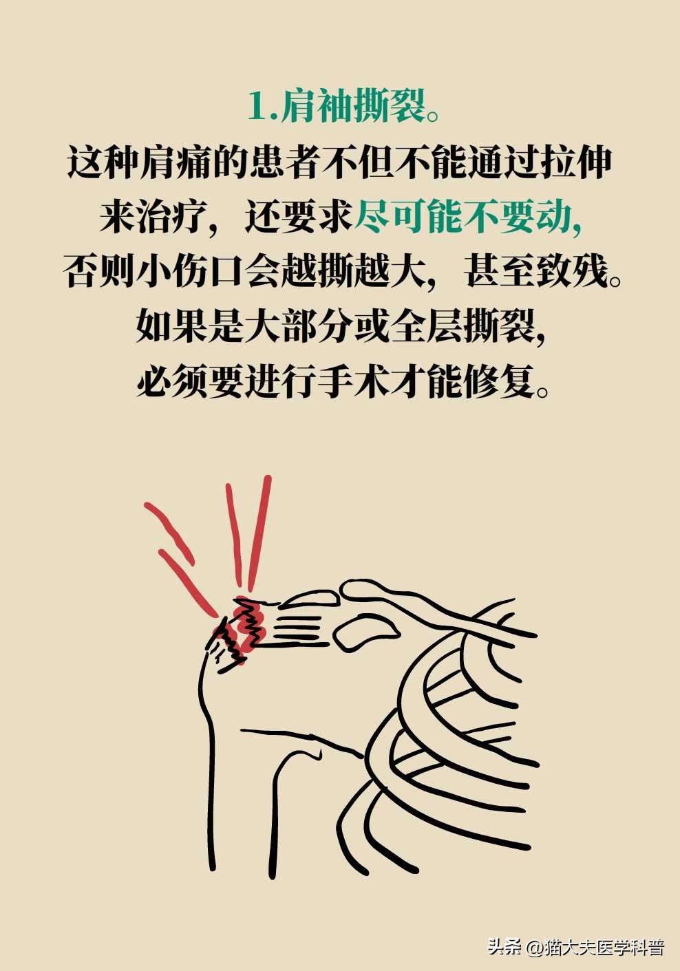 肩膀痛抬胳膊就痛是什么原因,肩膀疼痛做爬墙锻炼