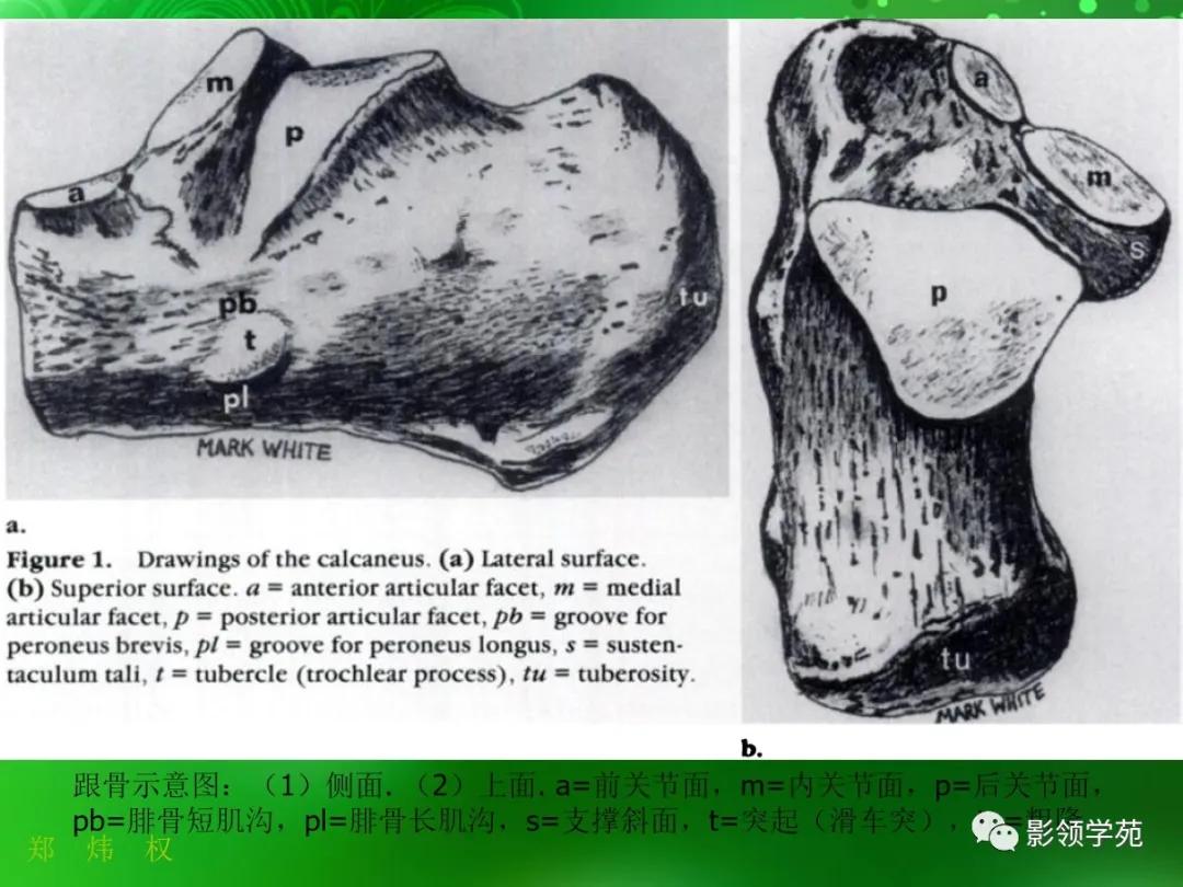正常跟骨影像图,跟骨正常与变异影像表现图片