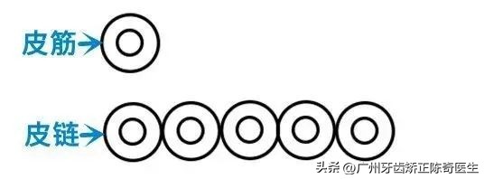 牙齿矫正橡皮筋怎么挂的,牙齿矫正橡皮筋用什么挂