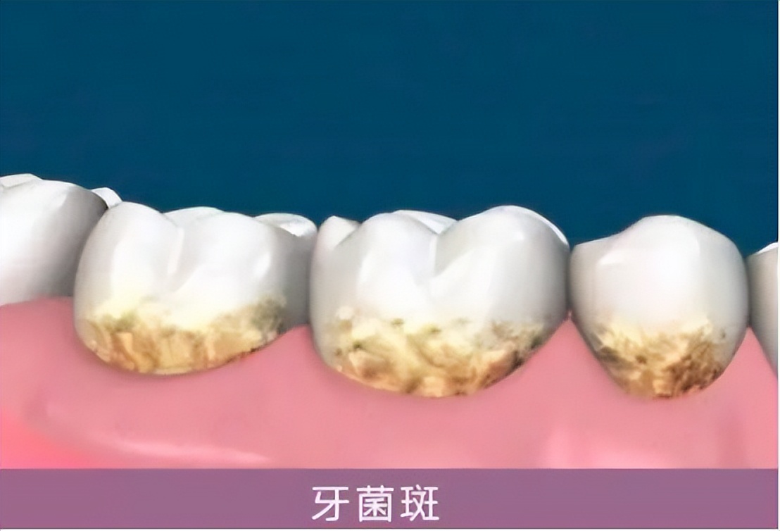 专家讲牙膏洗脸的危害,牙膏的雷区