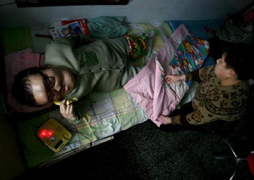 男孩得了怪病头部巨大,男孩得了怪病只有半个头