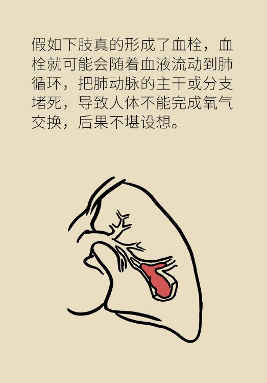 长途飞行腿部浮肿怎么办,长途旅行脚肿怎么办