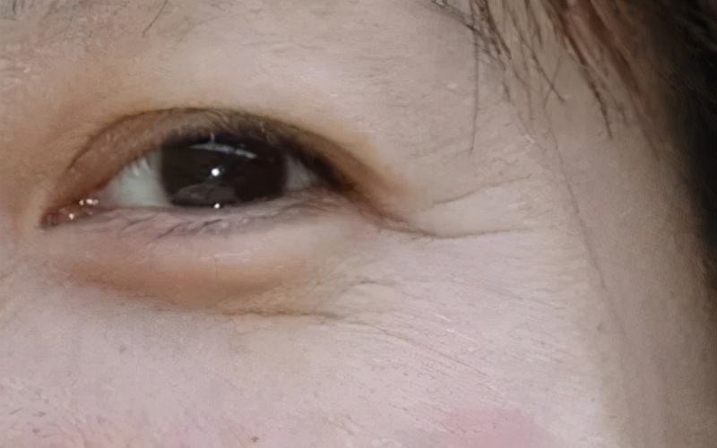 有了眼纹法令纹如何保养,护肤去眼纹鱼尾纹