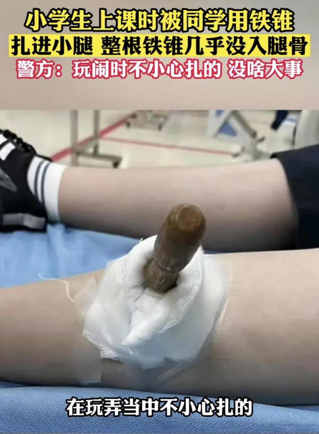 男孩被同学铁锥扎腿,小学生用铅笔扎伤同学可以报警吗