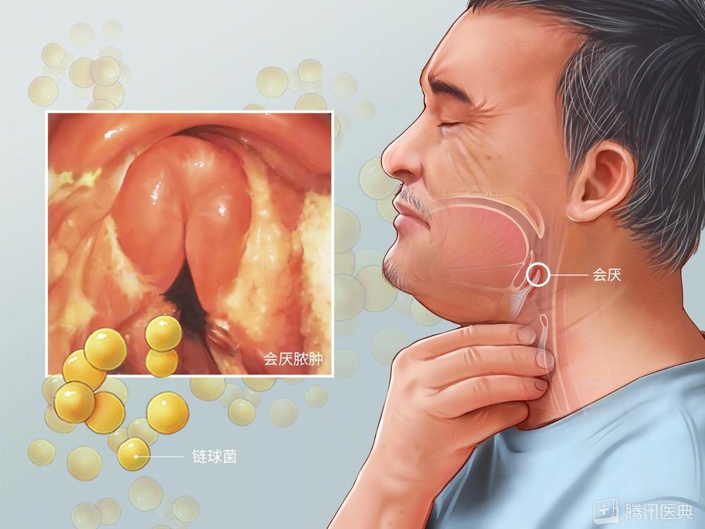 阳后喉咙痛会持续多久,半夜喉咙干疼要警惕四种疾病