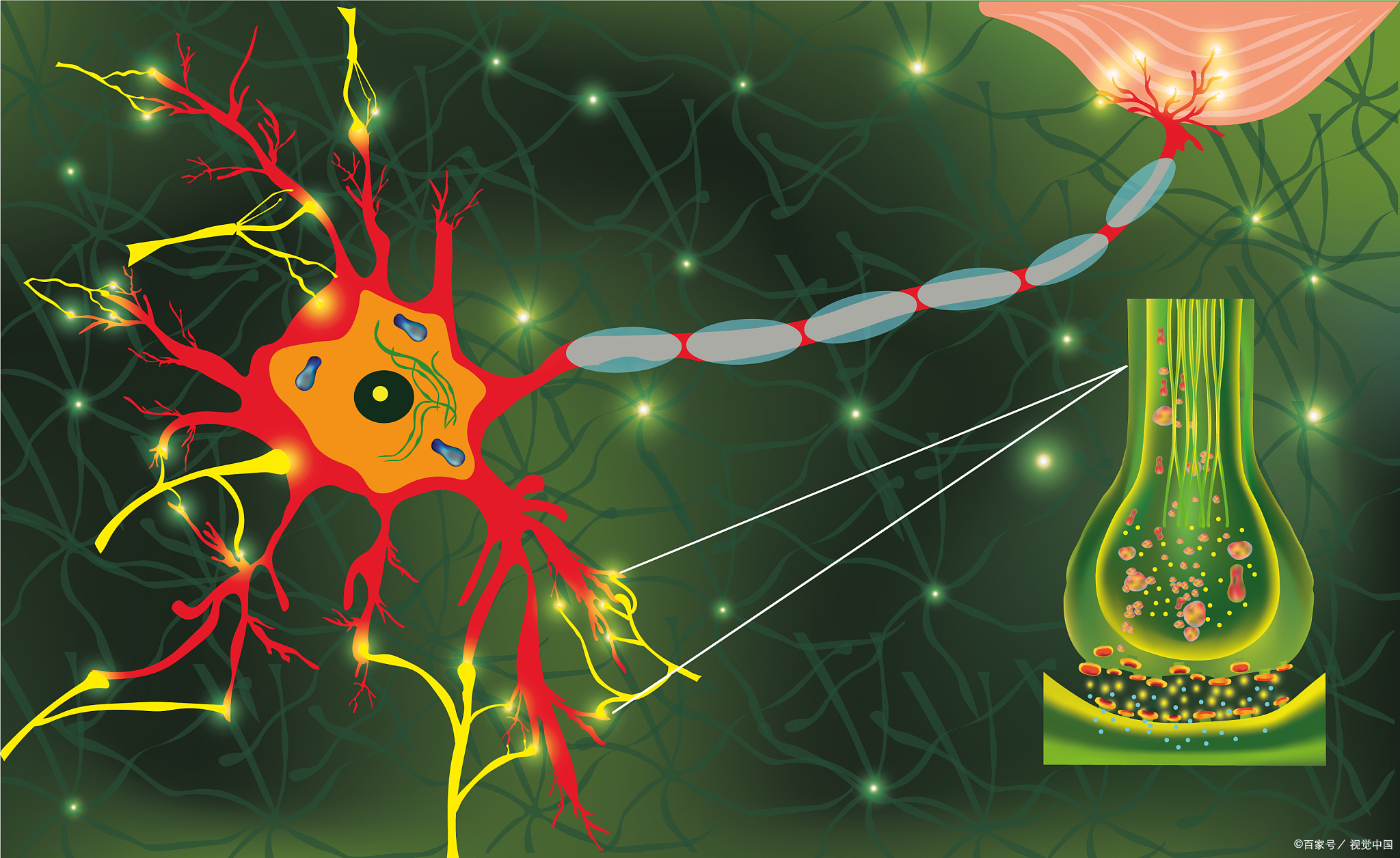 脑梗引起的失语能否恢复,脑梗引起失语能恢复吗