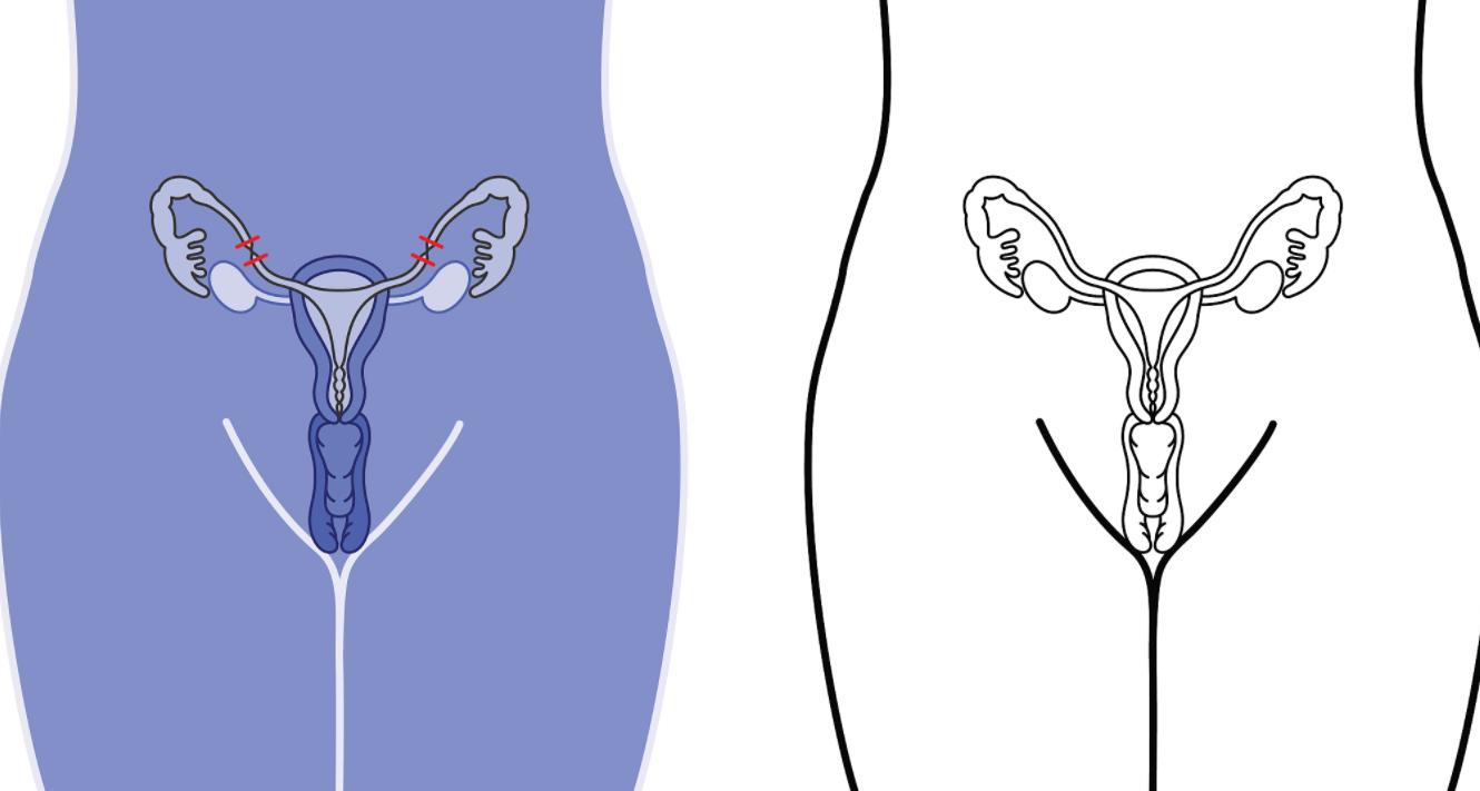 女性什么时候绝经比较好？绝经越迟，越容易长寿？很多人想错了