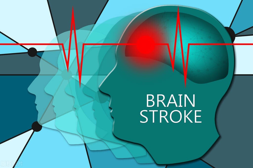 头皮堵塞会引发脑梗吗,头部血管病变有什么症状