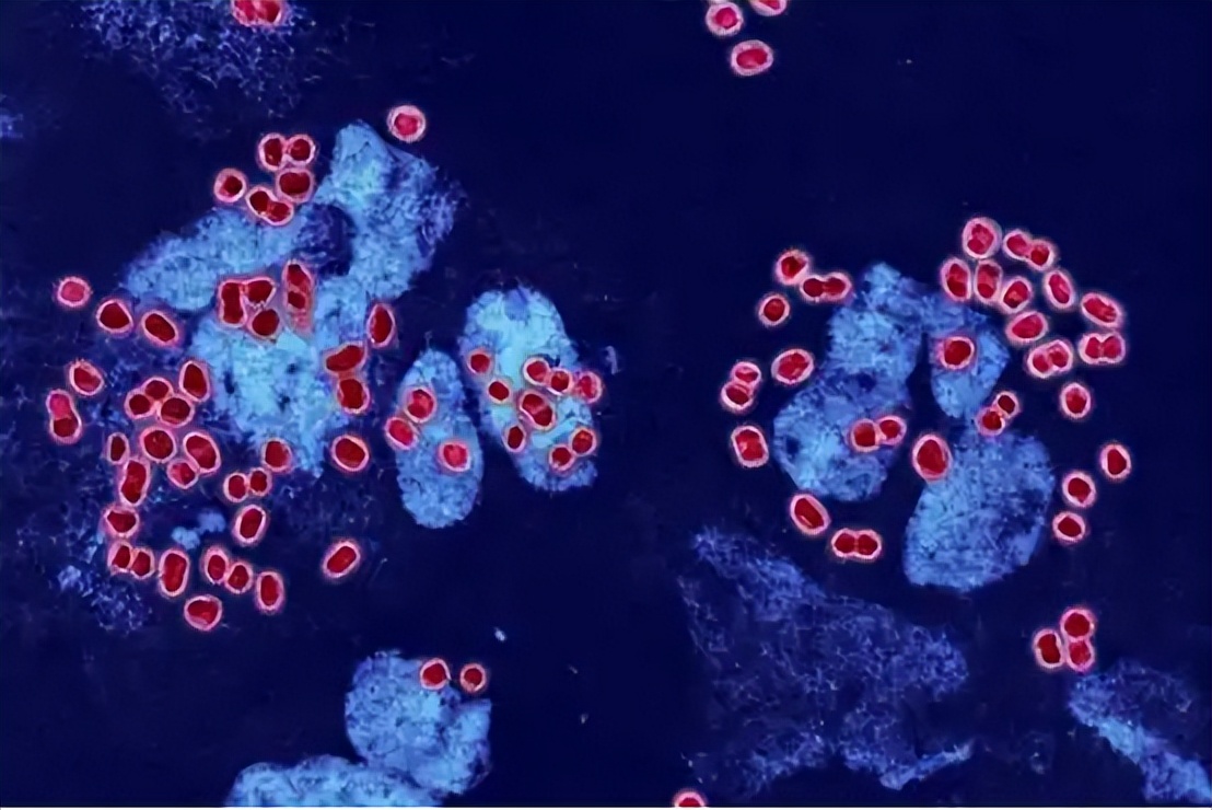 常见的性传播疾病有哪些如何预防,通过性传播的疾病哪个最严重