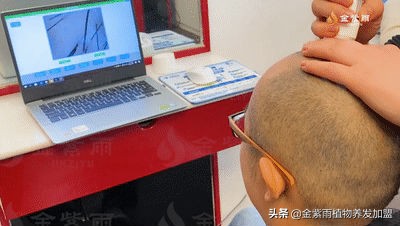 养发馆经营技巧和方法有哪些,现在做养发馆怎么样呢