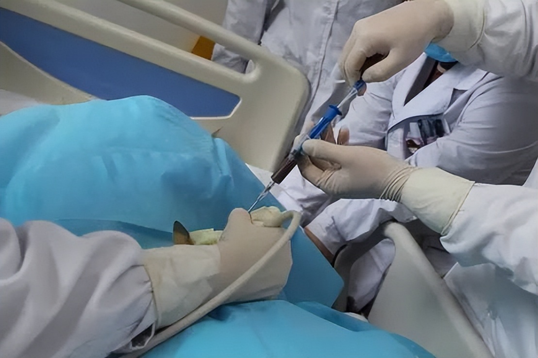 “一根细针”解除九旬病患的病痛！泗泾医院为高龄老人完成经皮经肝胆囊穿刺置管引流手术