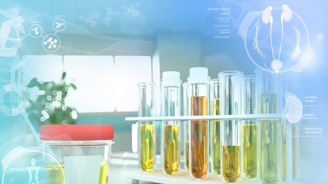 腰不疼尿血怎么回事,腰有点痛出现血尿是什么原因