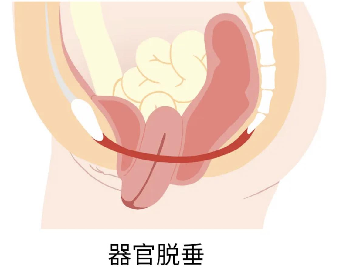痛苦的疾病治疗,妇科疾病有没有完全治愈的