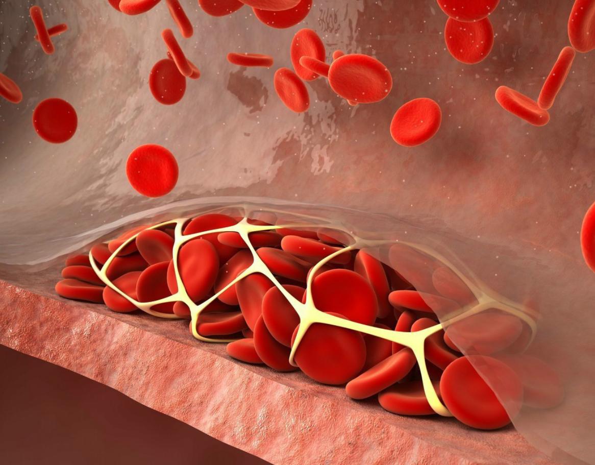 颈动脉硬化有斑块要吃阿司匹林吗,发现颈动脉斑块必须吃药吗