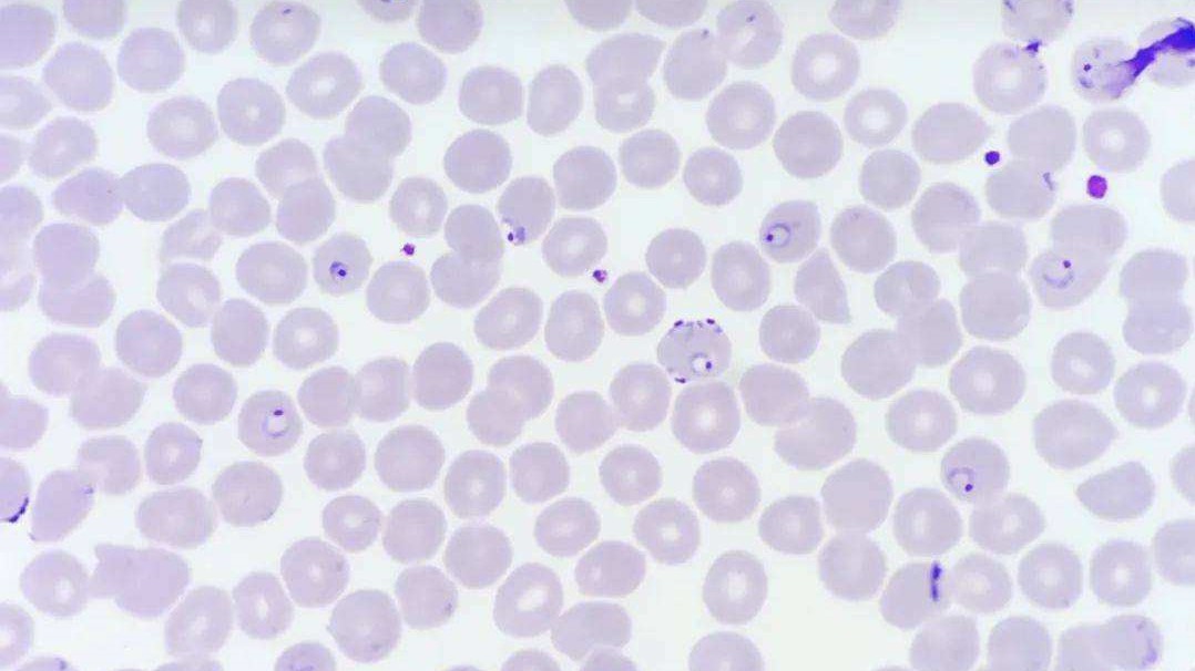 一瓶“甲硝唑”几块钱，或许能“摆平”4种病，不妨了解一下