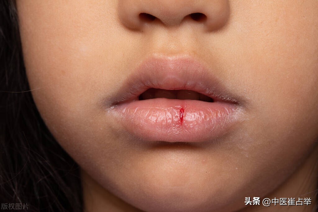 口干舌燥是心阴虚还是肾阴虚,裂纹舌肾阴虚怎么调理