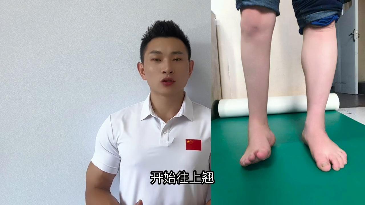 体态矫正足内翻,足内翻怎么自己矫正