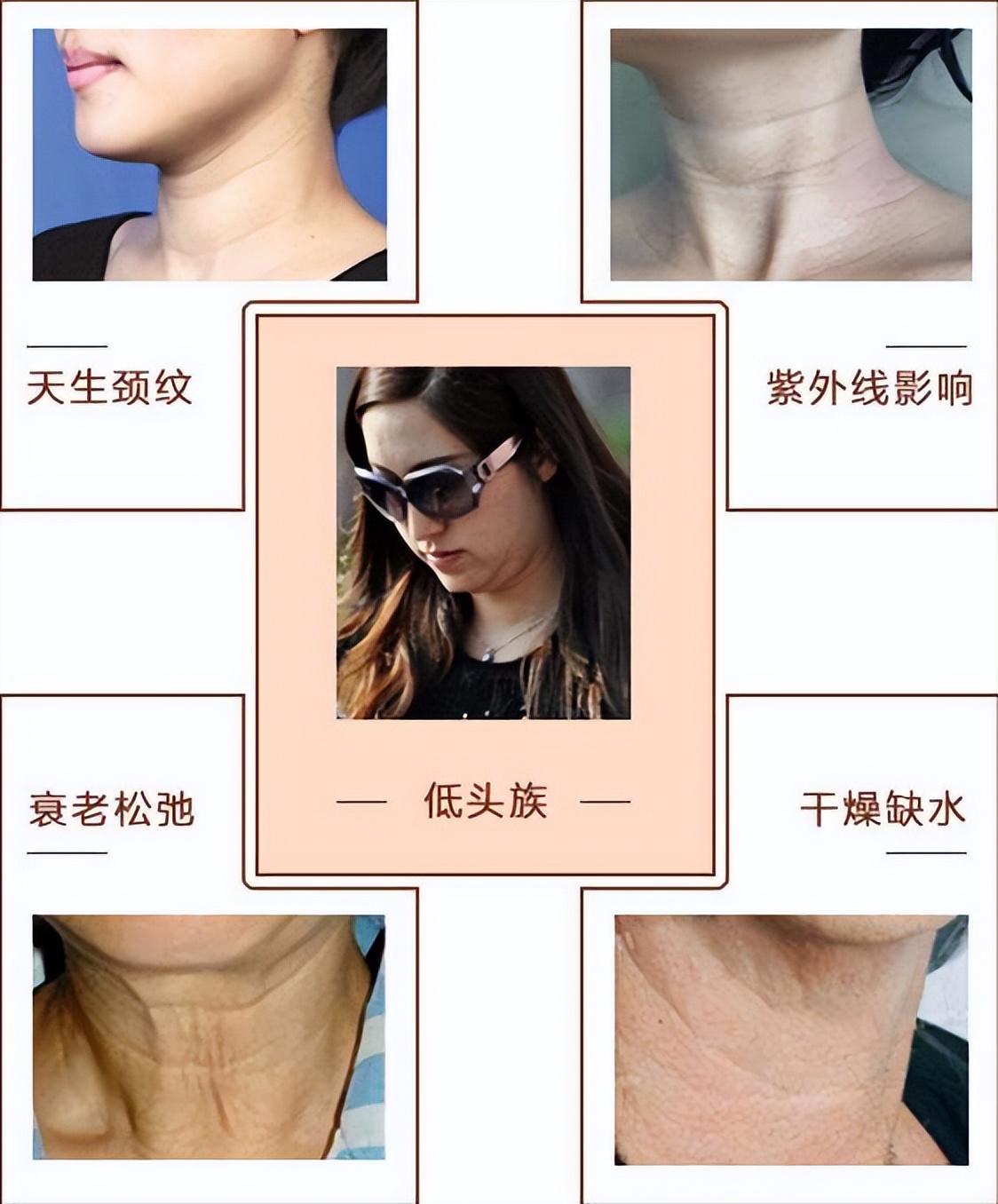 脖子上的纹怎么消除学生,脖子怎么祛皱