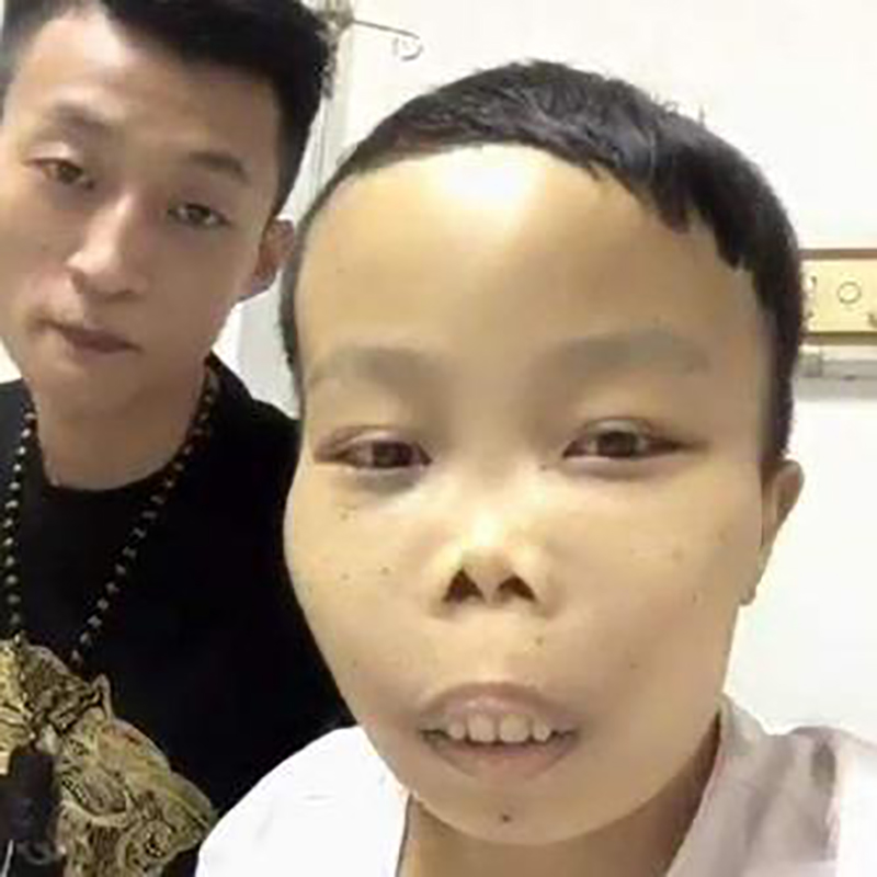 曾经的网红陈山现在的处境,陈山为什么成网红