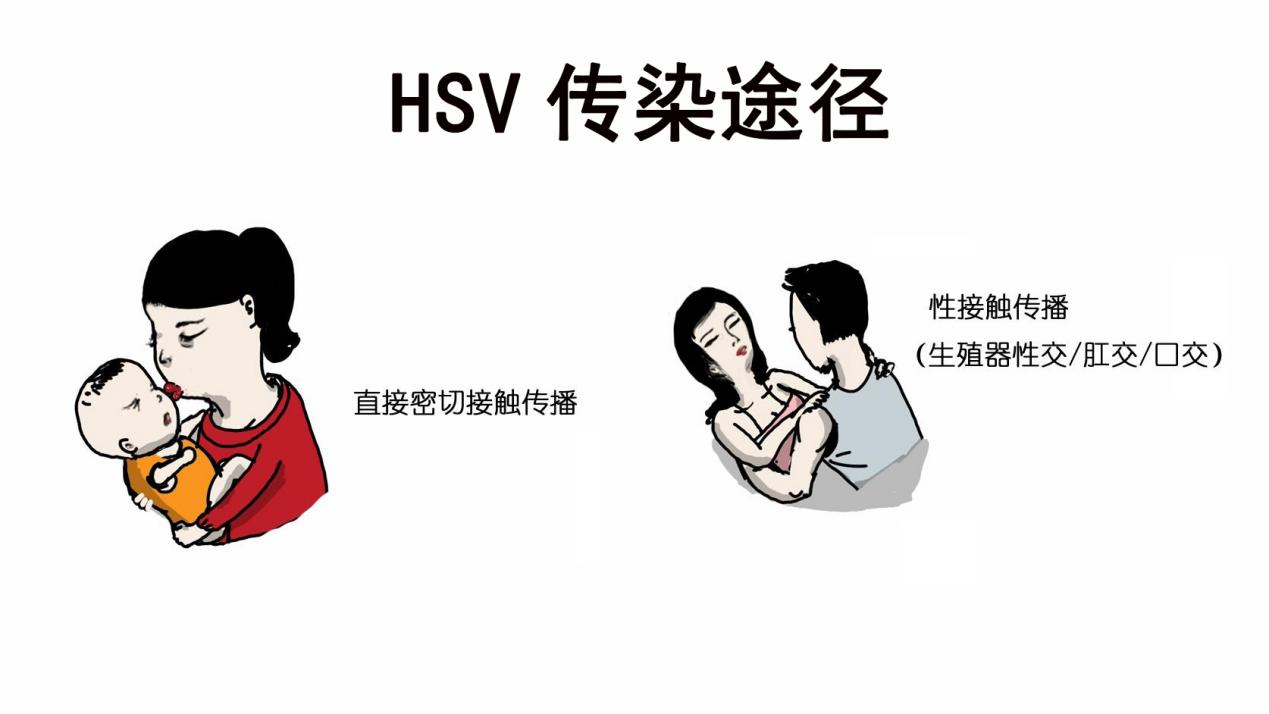 上火引起眼睛不适的症状有哪些,各种上火对应的症状及解决办法