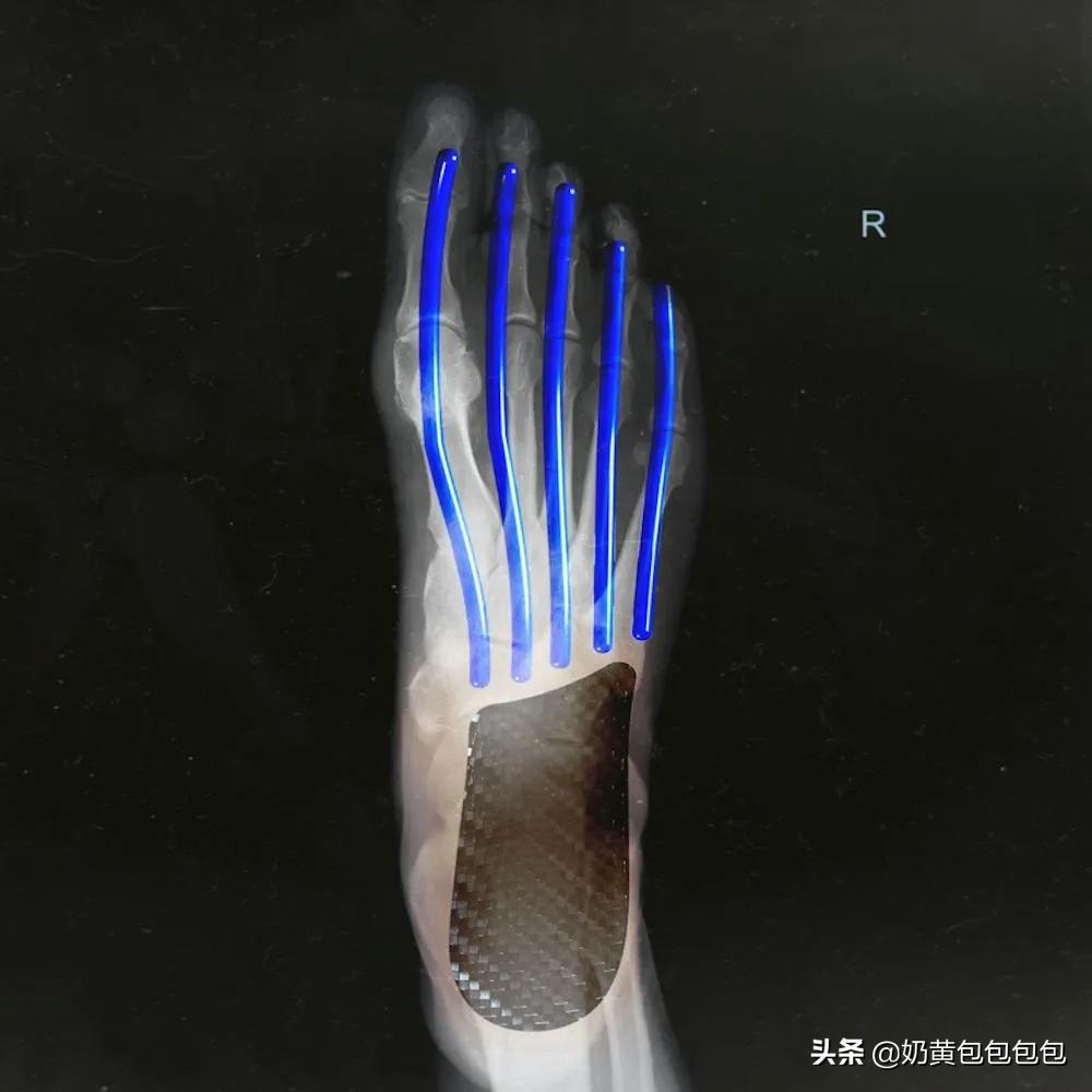 马拉松碳板鞋优势,马拉松next2碳板zoom竞速跑鞋