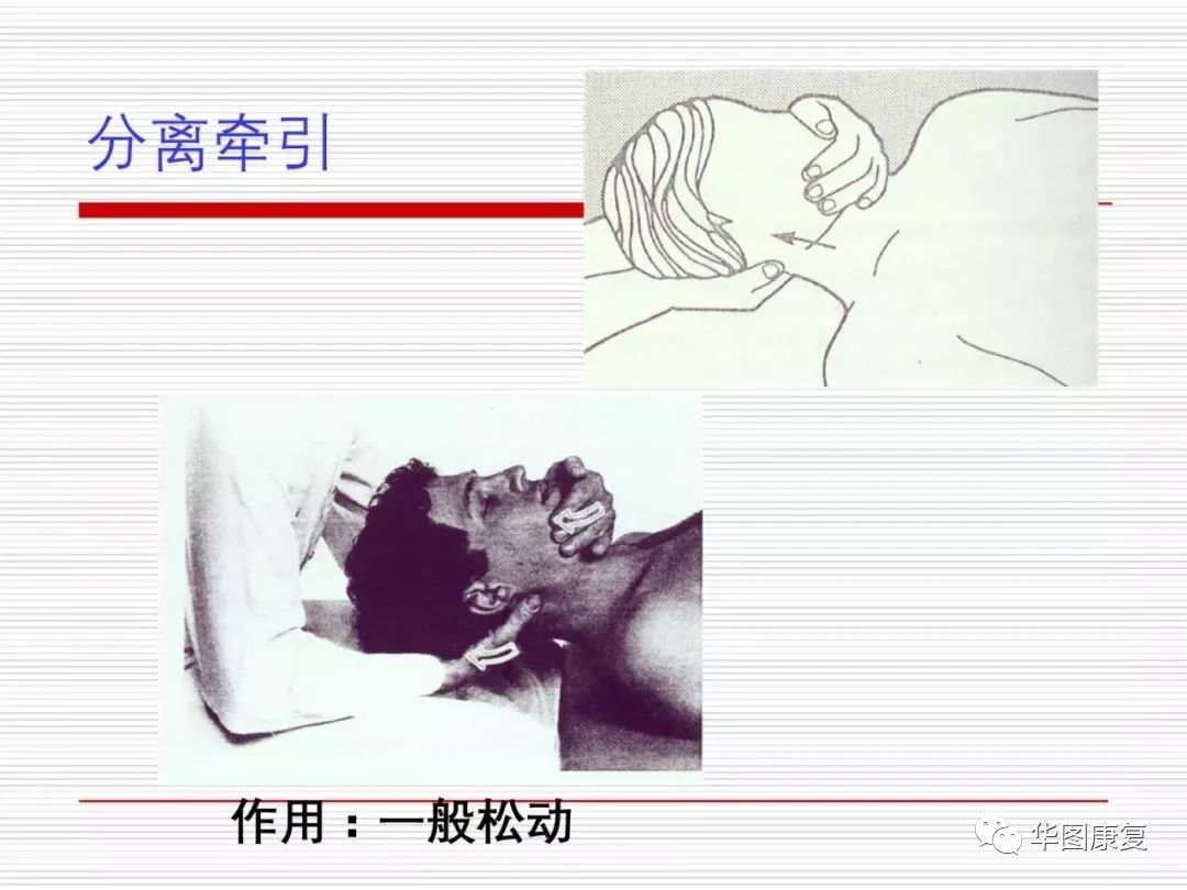 颈复康治疗颈源性头痛吗,颈源性头痛整体解决方案