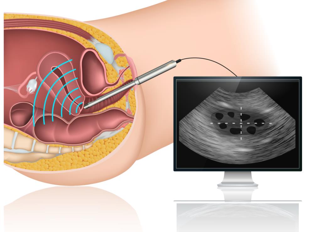 19岁女大学生离世捐器官救5人,20岁女大学生捐卵