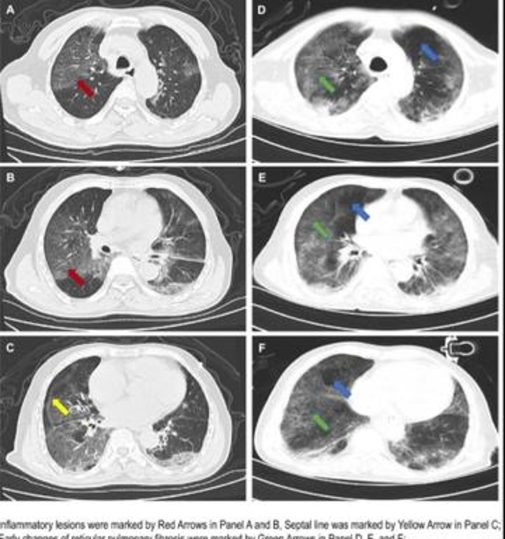 2023年12月11日2点11分,2023年12月11日11点43分