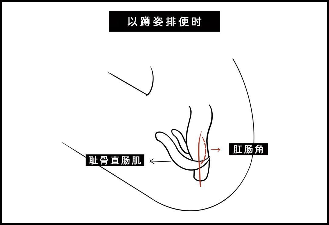 被公厕水溅到会得淋病吗,被公厕水溅到会感染吗