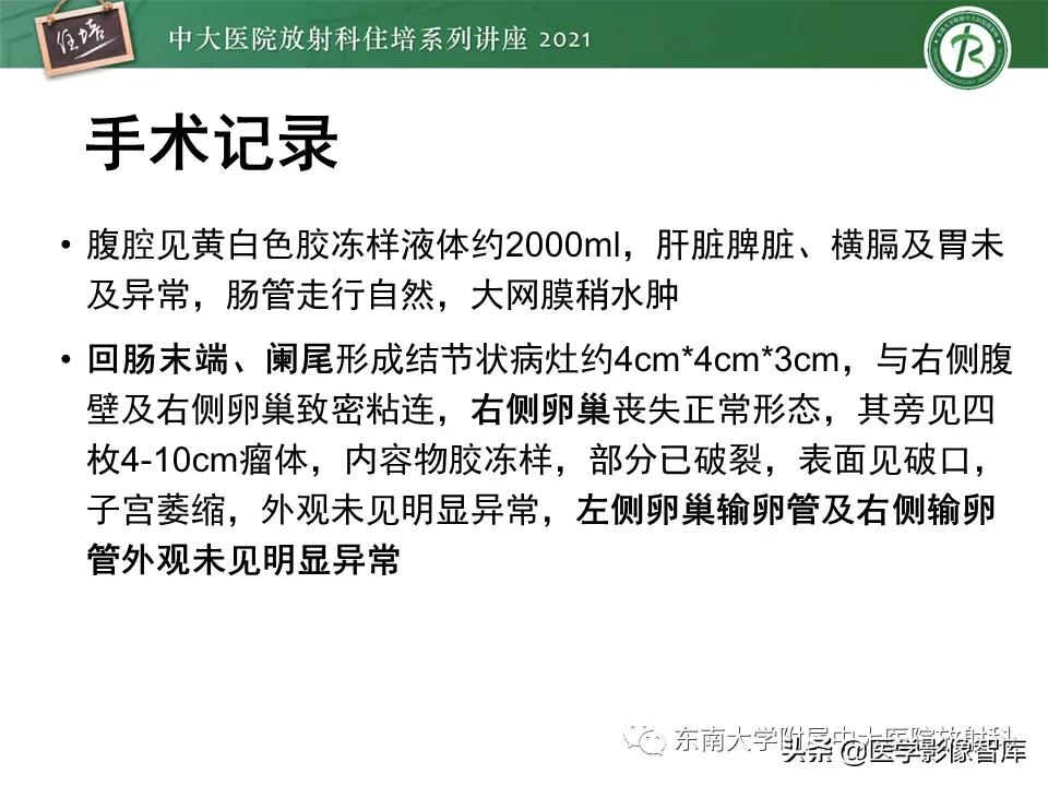卵巢浆液性肿瘤的肉眼及镜下特征,卵巢原发性粘液性囊腺瘤