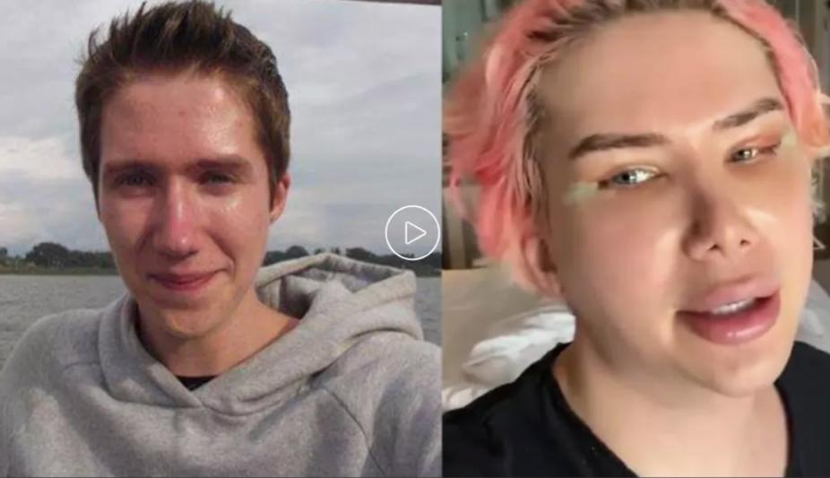 疯狂整容的网红,美国白人网红整成韩国人