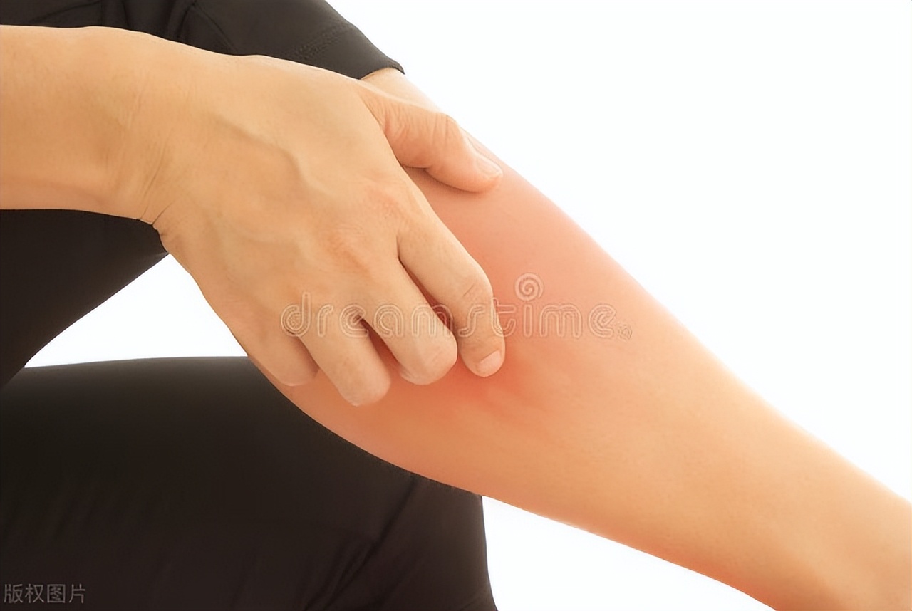 瘙痒是疾病还是症状,皮肤瘙痒如何分辨是什么病