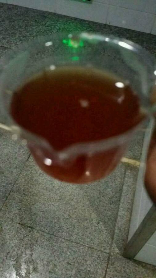 膀胱癌症啥症状影响大便吗,身体有癌小便先知