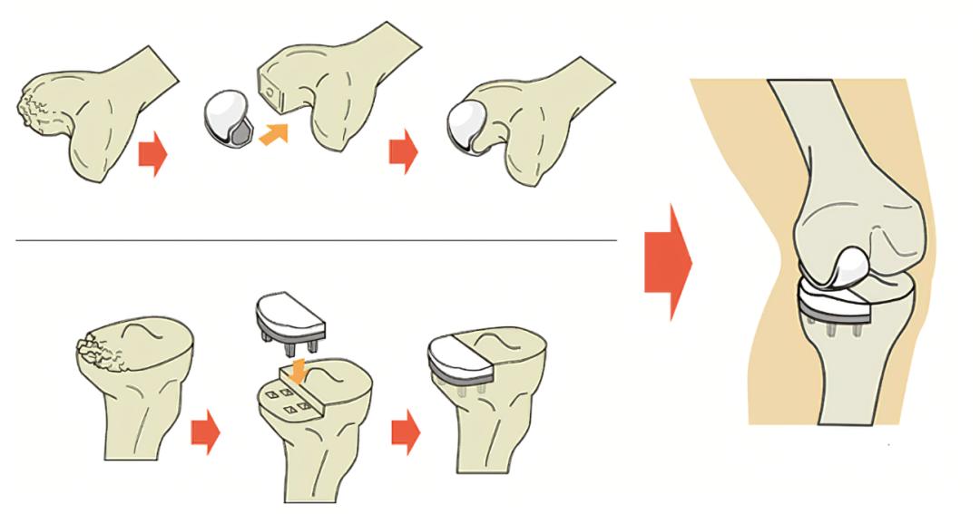 关节不听使唤僵硬怎么回事,关节不舒服老是不自觉使劲