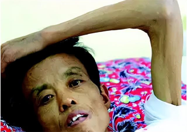 因为安乐死杀人的案例,被判安乐死案例