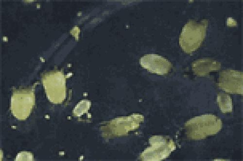 小孩内裤不勤换,小孩不换短裤危害